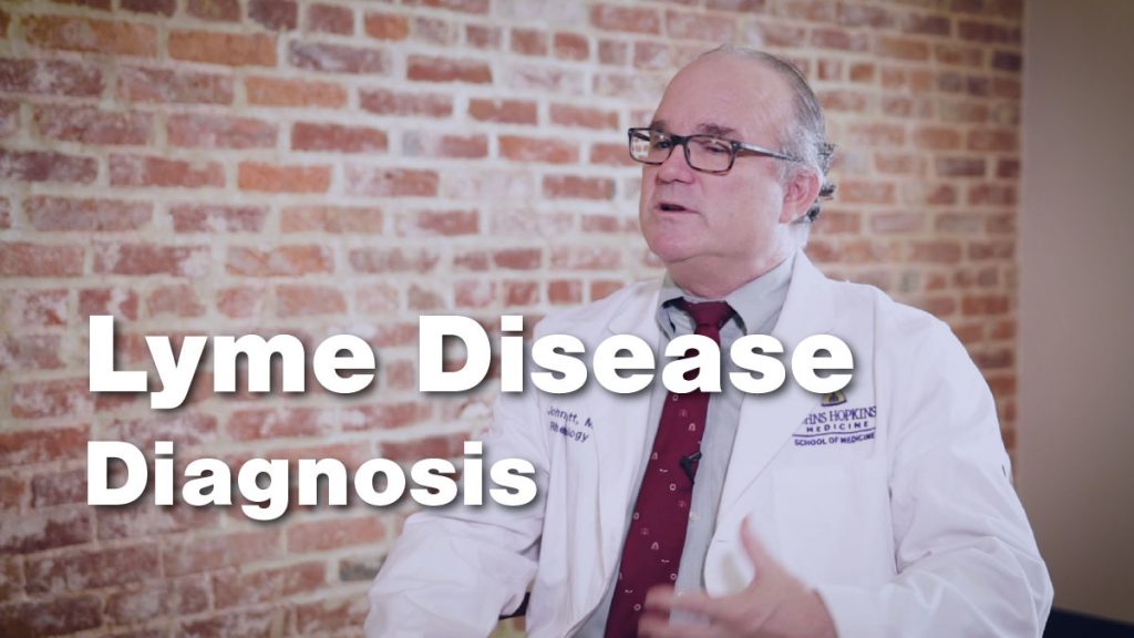 Diagnosis Lyme Disease • Johns Hopkins Rheumatology