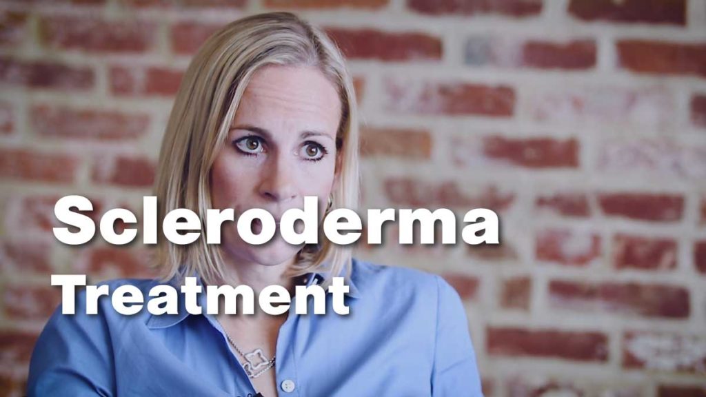 Treatment Of Scleroderma • Johns Hopkins Rheumatology