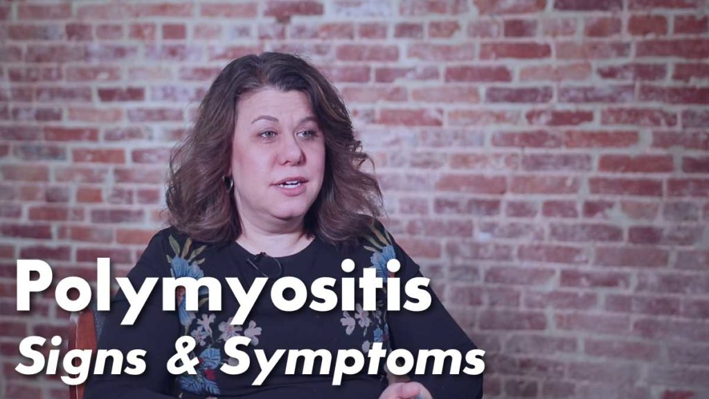 Polymyositis-Signs-Featured • Johns Hopkins Rheumatology